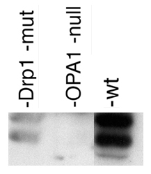 OPA1 Antibody - Staining in prostatic smooth muscle and glandular epithelium. Human Prostate 40X magnification.  This image was taken for the unconjugated form of this product. Other forms have not been tested.