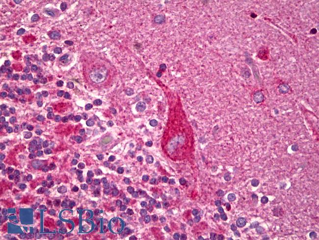 OPA1 Antibody - Anti-OPA1 antibody IHC of human brain, cerebellum, Purkinje cells. Immunohistochemistry of formalin-fixed, paraffin-embedded tissue after heat-induced antigen retrieval. Antibody dilution 1:100.  This image was taken for the unconjugated form of this product. Other forms have not been tested.