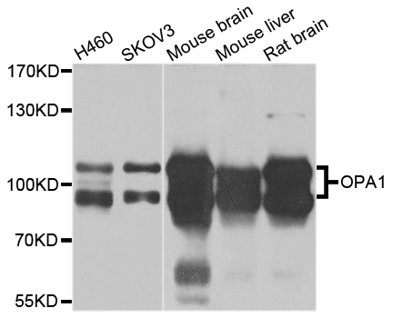 OPA1 Antibody - Western blot analysis of extracts of various cell lines.