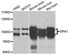 OPA1 Antibody - Western blot analysis of extracts of various cell lines.
