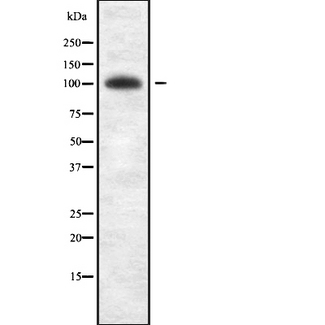 OPA1 Antibody - Western blot analysis of OPA1 antibody expression in A431 cells lysates.
