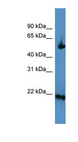 OPA3 Antibody - OPA3 antibody Western blot of Fetal Kidney lysate.  This image was taken for the unconjugated form of this product. Other forms have not been tested.