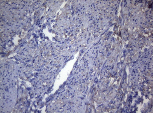 OPA3 Antibody - Immunohistochemical staining of paraffin-embedded Human endometrium tissue within the normal limits using anti-OPA3 mouse monoclonal antibody. (Heat-induced epitope retrieval by 1mM EDTA in 10mM Tris buffer. (pH8.5) at 120°C for 3 min. (1:150)