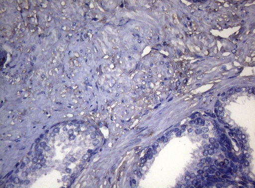 OPA3 Antibody - Immunohistochemical staining of paraffin-embedded Human prostate tissue within the normal limits using anti-OPA3 mouse monoclonal antibody. (Heat-induced epitope retrieval by 1mM EDTA in 10mM Tris buffer. (pH8.5) at 120°C for 3 min. (1:150)