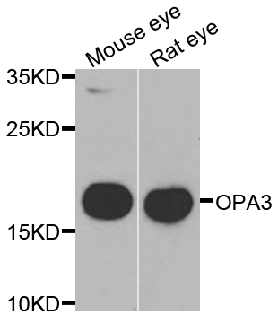 OPA3 Antibody - Western blot analysis of extracts of various cell lines.