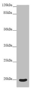 OPA3 Antibody - Western blot All Lanes:OPA3 antibody at 4.91 ug/ml +Mouse eye tissue Secondary Goat polyclonal to rabbit IgG at 1/10000 dilution Predicted band size: 20,21 kDa Observed band size: 20 kDa