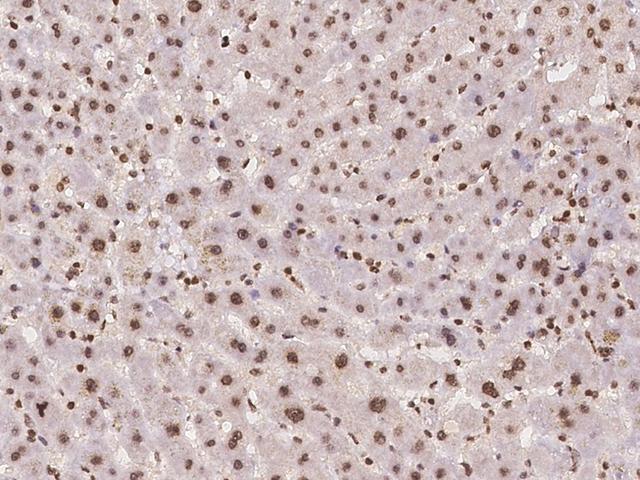 OPA3 Antibody - Immunochemical staining of human OPA3 in human liver with rabbit polyclonal antibody at 1:500 dilution, formalin-fixed paraffin embedded sections.