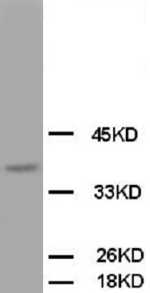 OPCML / OBCAM Antibody -  This image was taken for the unconjugated form of this product. Other forms have not been tested.