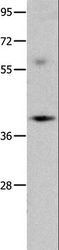 OPCML / OBCAM Antibody - Western blot analysis of Mouse brain tissue, using OPCML Polyclonal Antibody at dilution of 1:400.