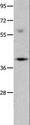 OPCML / OBCAM Antibody - Western blot analysis of Mouse brain tissue, using OPCML Polyclonal Antibody at dilution of 1:400.
