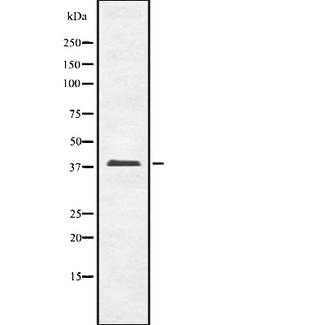 OPCML / OBCAM Antibody - Western blot analysis OBCAM using LOVO cells whole cells lysates