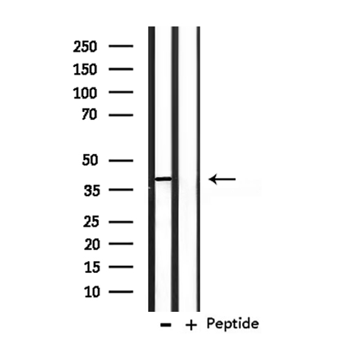 OPCML / OBCAM Antibody - Western blot analysis of extracts of mouse brain tissue using OBCAM antibody.