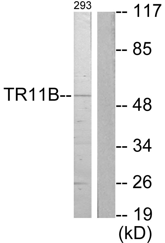 OPG / Osteoprotegerin Antibody - Western blot analysis of lysates from 293 cells, using TR11B Antibody . The lane on the right is blocked with the synthesized peptide.