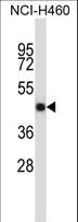 OPG / Osteoprotegerin Antibody - TNFRSF11B Antibody western blot of NCI-H460 cell line lysates (35 ug/lane). The TNFRSF11B antibody detected the TNFRSF11B protein (arrow).