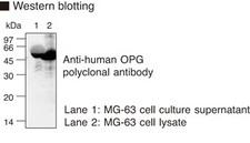 OPG / Osteoprotegerin Antibody