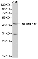 OPG / Osteoprotegerin Antibody - Western blot of extracts of 293T cell lines, using TNFRSF11B antibody.