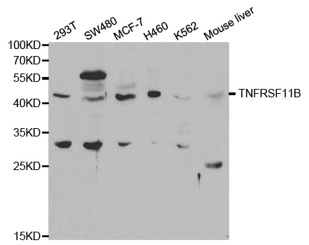 OPG / Osteoprotegerin Antibody - Western blot analysis of extracts of various cell lines.