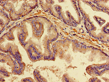 OPG / Osteoprotegerin Antibody - Immunohistochemistry image of paraffin-embedded human prostate tissue at a dilution of 1:100