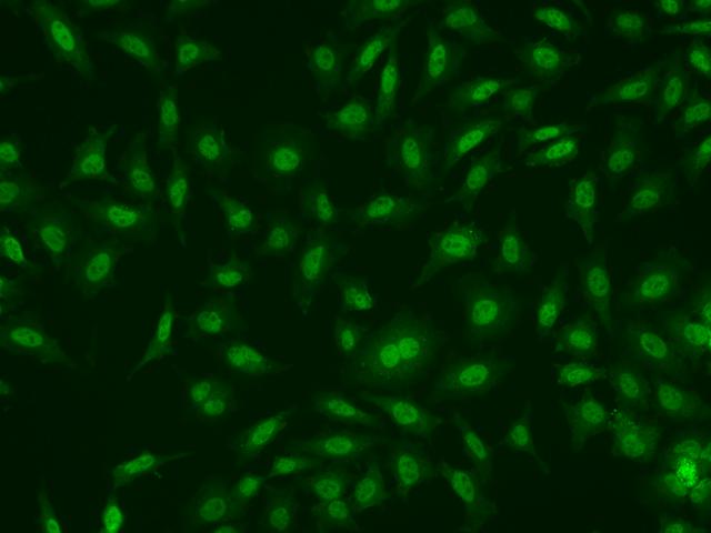 OPG / Osteoprotegerin Antibody - Immunofluorescence staining of TNFRSF11B in Hela cells. Cells were fixed with 4% PFA, permeabilzed with 0.1% Triton X-100 in PBS, blocked with 10% serum, and incubated with rabbit anti-Human TNFRSF11B polyclonal antibody (dilution ratio 1:200) at 4°C overnight. Then cells were stained with the Alexa Fluor 488-conjugated Goat Anti-rabbit IgG secondary antibody (green). Positive staining was localized to Nucleus.