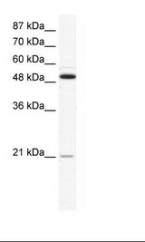 OPG / Osteoprotegerin Antibody - HepG2 Cell Lysate.  This image was taken for the unconjugated form of this product. Other forms have not been tested.