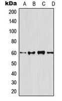 OPG / Osteoprotegerin Antibody - Western blot analysis of Osteoprotegerin expression in HeLa (A); mouse brain (B); rat brain (C); PC12 (D) whole cell lysates.