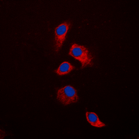 OPG / Osteoprotegerin Antibody - Immunofluorescent analysis of Osteoprotegerin staining in HeLa cells. Formalin-fixed cells were permeabilized with 0.1% Triton X-100 in TBS for 5-10 minutes and blocked with 3% BSA-PBS for 30 minutes at room temperature. Cells were probed with the primary antibody in 3% BSA-PBS and incubated overnight at 4 C in a humidified chamber. Cells were washed with PBST and incubated with a DyLight 594-conjugated secondary antibody (red) in PBS at room temperature in the dark. DAPI was used to stain the cell nuclei (blue).