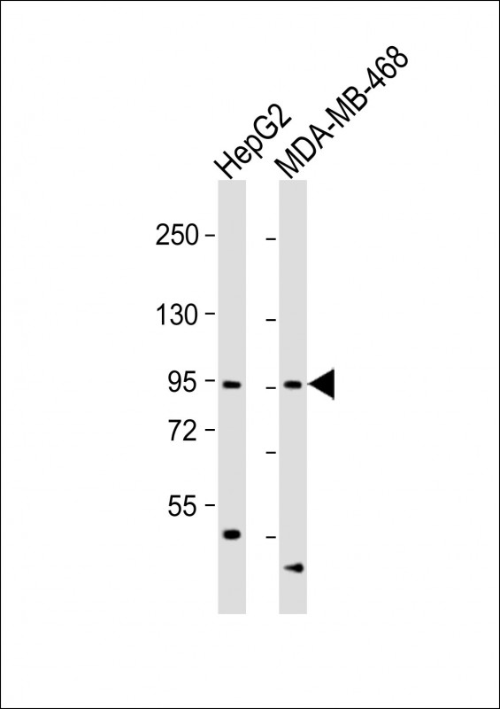 OPHN1 Antibody - All lanes: Anti-OPHN1 Antibody (Center) at 1:1000 dilution. Lane 1: HepG2 whole cell lysate. Lane 2: MDA-MB-468 whole cell lysate Lysates/proteins at 20 ug per lane. Secondary Goat Anti-Rabbit IgG, (H+L), Peroxidase conjugated at 1:10000 dilution. Predicted band size: 92 kDa. Blocking/Dilution buffer: 5% NFDM/TBST.