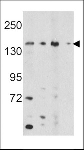 OPLAH Antibody - Western blot of OPLAH Antibody in K562, HepG2 cell line lysates and mouse bladder, liver tissue lysates (35 ug/lane). OPLAH (arrow) was detected using the purified antibody.