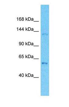 OPLAH Antibody - Western blot of OPLAH Antibody with human MCF7 Whole Cell lysate.  This image was taken for the unconjugated form of this product. Other forms have not been tested.