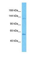 OPLAH Antibody - Western blot of OPLAH Antibody with human MCF7 Whole Cell lysate.  This image was taken for the unconjugated form of this product. Other forms have not been tested.