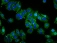 OPN1MW / GCP Antibody - Immunofluorescence staining of HepG2 cells diluted at 1:66, counter-stained with DAPI. The cells were fixed in 4% formaldehyde, permeabilized using 0.2% Triton X-100 and blocked in 10% normal Goat Serum. The cells were then incubated with the antibody overnight at 4°C.The Secondary antibody was Alexa Fluor 488-congugated AffiniPure Goat Anti-Rabbit IgG (H+L).