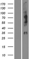 OPN1MW / GCP Protein - Western validation with an anti-DDK antibody * L: Control HEK293 lysate R: Over-expression lysate
