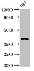 OPN1SW / Blue Opsin Antibody - Positive Western Blot detected in U87 whole cell lysate. All lanes: OPN1SW antibody at 3 µg/ml Secondary Goat polyclonal to rabbit IgG at 1/50000 dilution. Predicted band size: 40 KDa. Observed band size: 40 KDa