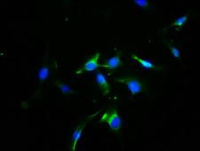 OPN1SW / Blue Opsin Antibody - Immunofluorescence staining of U251 cells with OPN1SW Antibody at 1:100, counter-stained with DAPI. The cells were fixed in 4% formaldehyde, permeabilized using 0.2% Triton X-100 and blocked in 10% normal Goat Serum. The cells were then incubated with the antibody overnight at 4°C. The secondary antibody was Alexa Fluor 488-congugated AffiniPure Goat Anti-Rabbit IgG(H+L).