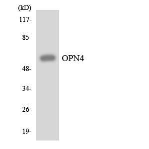 OPN4 / Melanopsin Antibody - Western blot analysis of the lysates from HeLa cells using OPN4 antibody.