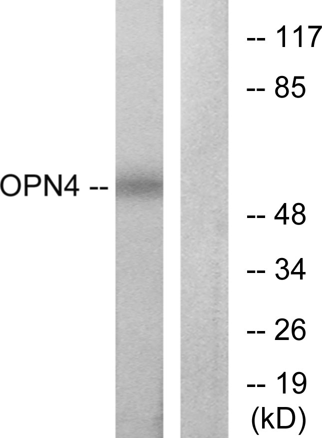 OPN4 / Melanopsin Antibody - Western blot analysis of lysates from COLO cells, using OPN4 Antibody. The lane on the right is blocked with the synthesized peptide.