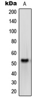 OPN4 / Melanopsin Antibody - Western blot analysis of Melanopsin expression in HEK293T (A) whole cell lysates.