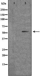 OPN4 / Melanopsin Antibody - Western blot analysis of extracts of COLO cells using OPN4 antibody. The lane on the left is treated with the antigen-specific peptide.