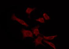 OPN4 / Melanopsin Antibody - Staining COLO205 cells by IF/ICC. The samples were fixed with PFA and permeabilized in 0.1% Triton X-100, then blocked in 10% serum for 45 min at 25°C. The primary antibody was diluted at 1:200 and incubated with the sample for 1 hour at 37°C. An Alexa Fluor 594 conjugated goat anti-rabbit IgG (H+L) Ab, diluted at 1/600, was used as the secondary antibody.
