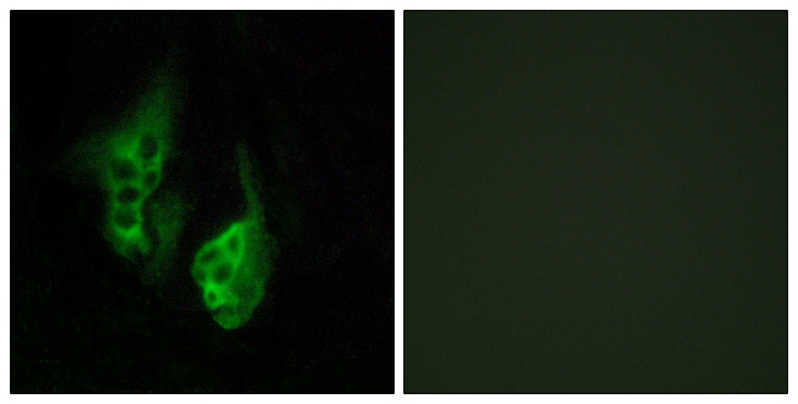 OPN5 / Neuropsin Antibody - Immunofluorescence analysis of HeLa cells, using OPN5 Antibody. The picture on the right is blocked with the synthesized peptide.