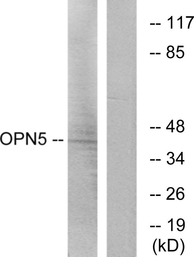 OPN5 / Neuropsin Antibody - Western blot analysis of lysates from Jurkat cells, using OPN5 Antibody. The lane on the right is blocked with the synthesized peptide.