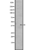 OPN5 / Neuropsin Antibody - Western blot analysis of GPR136 expression in HuvEc cells lysate. The lane on the left is treated with the antigen-specific peptide.