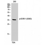 OPRD1 / Delta Opioid Receptor Antibody - Western blot of Phospho-DOR-1 (S363) antibody