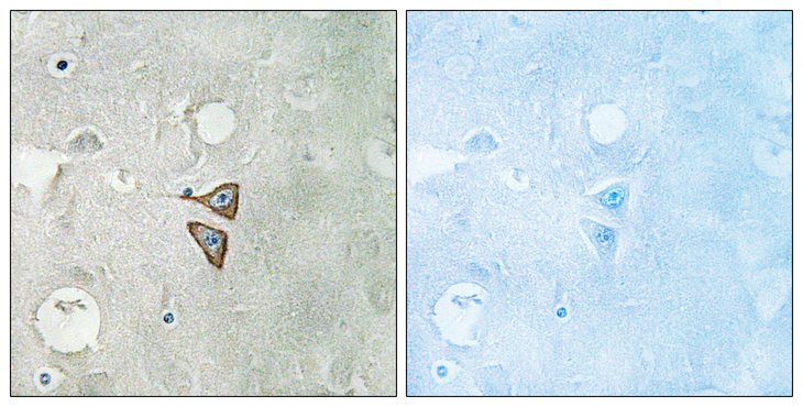 OPRD1 / Delta Opioid Receptor Antibody - Immunohistochemistry analysis of paraffin-embedded human brain tissue, using Opioid Receptor-delta Antibody. The picture on the right is blocked with the synthesized peptide.