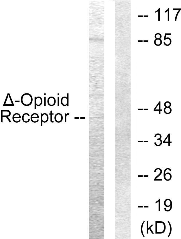 OPRD1 / Delta Opioid Receptor Antibody - Western blot analysis of extracts from COS7 cells, using Opioid Receptor-d (Ab-363) Antibody.