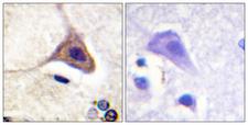 OPRD1 / Delta Opioid Receptor Antibody - Immunohistochemistry analysis of paraffin-embedded human brain, using Opioid Receptor-delta (Phospho-Ser363) Antibody. The picture on the right is blocked with the phospho peptide.