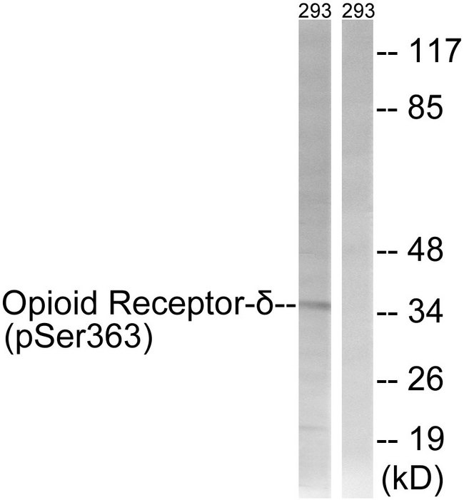 OPRD1 / Delta Opioid Receptor Antibody - Western blot analysis of lysates from 293 cells treated with TSA 400nM 24h, using Opioid Receptor-delta (Phospho-Ser363) Antibody. The lane on the right is blocked with the phospho peptide.