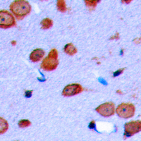 OPRD1 / Delta Opioid Receptor Antibody - Immunohistochemical analysis of Delta Opioid Receptor (pS363) staining in human brain formalin fixed paraffin embedded tissue section. The section was pre-treated using heat mediated antigen retrieval with sodium citrate buffer (pH 6.0). The section was then incubated with the antibody at room temperature and detected using an HRP conjugated compact polymer system. DAB was used as the chromogen. The section was then counterstained with hematoxylin and mounted with DPX.