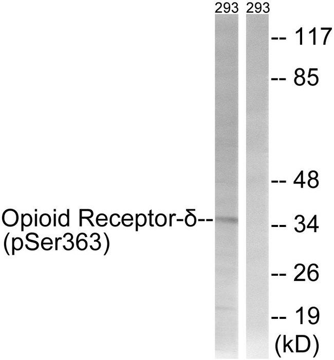 OPRD1 / Delta Opioid Receptor Antibody - Western blot analysis of extracts from 293 cells, treated with TSA (400nM, 24hours), using Opioid Receptor-d (Phospho-Ser363) antibody.