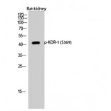 OPRK1 / Kappa Opioid Receptor Antibody - Western blot of Phospho-KOR-1 (S369) antibody